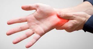 Doctors call this stenosing tenosynovitis. Recovering From Hand Or Wrist Surgery Athrohab