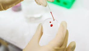 What are blood titers and how do they work? Can Your Blood Test Show If You Are Taking Drugs Justbob