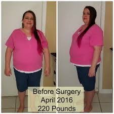 Pin On Our Specialist Of Weight Loss Surgery Los Angeles