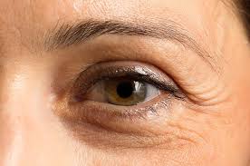 What causes eyebrow hair loss? Eyebrow Hair Loss Causes And Treatments In Iran Gomediran
