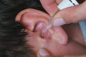 Fill a dropper with the solution. Ear Wax Removal 101 The Best And Safest Ways To Clear Clogged Ears Health Essentials From Cleveland Clinic