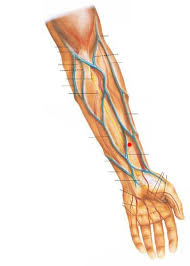 Dolor Despues De Clavarme Un Punzon En El Antebrazo Medicina Todoexpertos Com