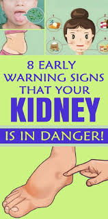 8 Signs You May Have Kidney Failure Kidney Damage Cardiovascular Conditions Health