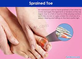 If you have a sprained toe, what you've injured is actually the ligaments around the toe. Sprained Toe Causes Symptoms Treatment Diagnosis