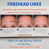 Get insights on how to get rid of wrinkles on forehead fast, naturally, without botox, methods suitable for men, teenagers, women, best cream and home remedies. 1