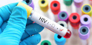 Women with hiv can pass it to their babies before or during birth, and through breastfeeding. Quiz Test Your Knowledge About Hiv Proprofs Quiz