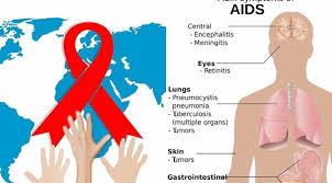 Kebanyakan orang dengan hiv/aids (odha) tetap asimtomatik (tanpa tanda dan gejala dari suatu. Gejala Penyakit Hiv Kenali Sejak Dini Untuk Mencegah Aids