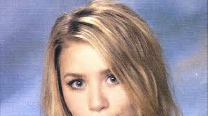 AVANT/APRES : Ces stars qui ont abusé de la chirurgie esthétique (PHOTOS)