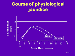 neonatal jaundice by dr nahed al nagger ppt video online