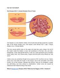 How do people get cold sores? Can Hsv1 Be Treated By Michaelsjulia260 Issuu