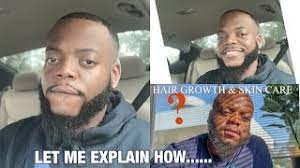 Find new and preloved canvas beauty items at up to 70% off retail prices. I Got My Hair Line Back Fast Beard Growth Canvas Beauty King S Beard Scalp Enriching Serum Youtube