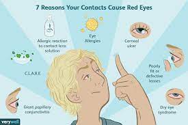 Many people take longer to get used to rigid contacts than to soft. Causes Of Red Eyes In Contact Wearers