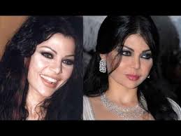 لو عشت بعدي وبعد بعدي وجيت وحبيت ابقي افتكرني واحكي عني مهما كنت نسيت خليني ذكري جميلة عندك واوعي تنسي زمان خليني ذكري جميلة عندك واوعي تنسي زمان. Ù‡ÙŠÙØ§Ø¡ ÙˆÙ‡Ø¨ÙŠ Ù‚Ø¨Ù„ ÙˆØ¨Ø¹Ø¯ Ø¹Ù…Ù„ÙŠØ§Øª Ø§Ù„ØªØ¬Ù…ÙŠÙ„ Haifa Wehbe Before After Surgery Youtube