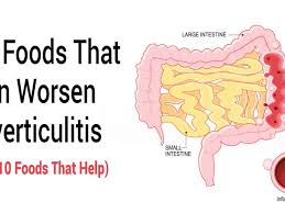 See more of diverticulitis foods to avoid on facebook. 10 Foods That Can Worsen Diverticulitis And 10 Foods That Help