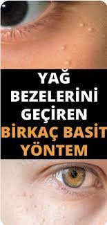Goz Altindaki Yag Bezeleri Nasil Gecer Cilt Tedavileri Saglik Cilt Urunleri
