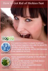 Pin On Top 10 Home Remedies