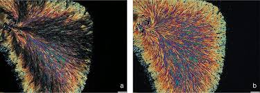 Image result for Polarized Microscopy