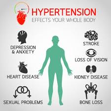 Hypertension: Symptoms and Causes - Pulse Cardiology