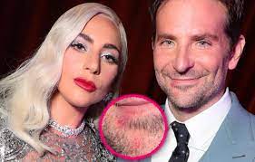 Leur rencontre a incontestablement bouleversé chacune de leur vie : Lady Gaga S Lipstick Seen On Bradley Cooper S Mouth