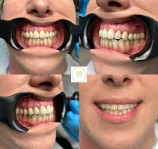 Bálint Dental Fogtechnikai Kft.