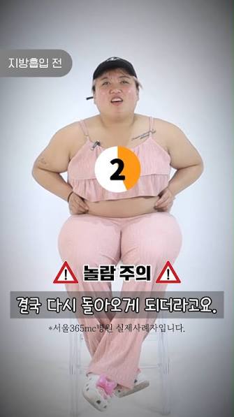 서울365mc병원 | 지방흡입, 람스, 허파고리 | #서울365mc_지방흡입 #서울365mc_팔지방흡입 무더운 여름🔥 일자팔  만들고🙌 끈나시 자주 입게 되죠😆 끈나시+청바지=로망 끝판왕🧡 #끈나시 #민소매나시 #여자들의로망 | Instagram