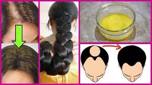 как избавиться от волос на теле раз и навсегда S Etoj Maskoj Vy Zabudete O Vypadenii Volos Raz I Navsegda Luchshaya Ma Domashnie Maski Dlya Volos Vypadenie Volos Volosy