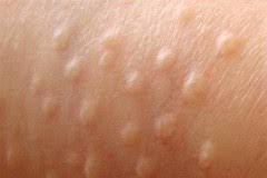 images?q=tbn:ANd9GcQodiLBcmA8l4M4z2ETUDC