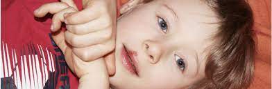 Mundfaule Stomatitis Aphtosa Herpes Virus Bei Kindern