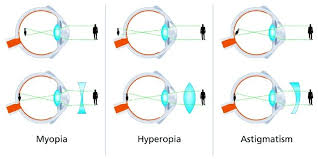 Image result for Presbyopia