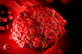 We don't know for sure, but, as dr linden explained, experts have a few theories which are backed by evidence. Scientists Find How Astrazeneca Vaccine Causes Clots