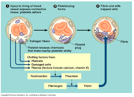 By breaking down the clot, the disease process can be arrested or the complications reduced. Https Www Murrieta K12 Ca Us Cms Lib Ca01000508 Centricity Domain 2206 Blood Clotting Notes Pdf