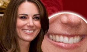 Kate Middleton'S Beauty Evolution - Best Old Photos Of Kate Middleton When  She Was Young | Marie Claire