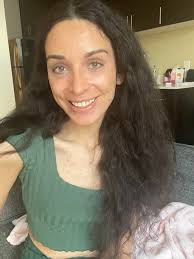 A few weeks ago, my exercise instructor asked me about my bumps. I  explained it was NF and gave her flyers I printed from ctg.org. We had a  chance to chat today