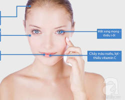Hình ảnh về Da khô là dấu hiệu thiếu vitamin và khoáng chất