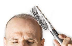 Hormonell Bedingter Haarausfall Bei Frau Mann Haarausfall Hilfe