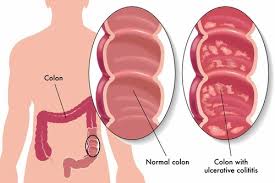 Adult 2 Gastrointestinal Flashcards Quizlet