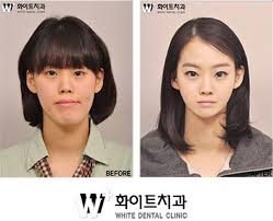 31 Crazy Before And After Photos Of Korean Plastic Surgery Korean Plastic Surgery South Korean Plastic Surgery Plastic Surgery Pictures
