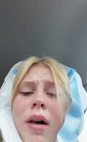 Will wisdom teeth removal straighten teeth? The Harsh Reality Of Wisdom Teeth Removal Lincoln High School Statesman