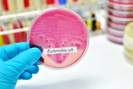 Penyakit Escherichia coli - Gejala, Penyebab, Pengobatan - Kompas.com