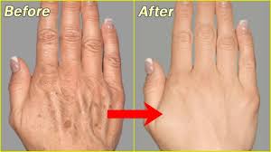 Thankfully, there are ways to keep the skin on your hands looking smooth and young. Remove Severe Hand Wrinkles Immediately Get Younger Looking Hands The Home Of Wellness