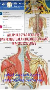 Banyak Sekali Jenis Jenis Penyakit Syaraf Salah Satunya Adalah Syaraf Kejepit Atau Hampir Sama Halnya Dengan Urat Terjepit Merupakan P Persamaan Jenis Penjepit