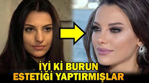 Iyiki De Burun Estetigi Yaptirmis Diyecegimiz Unluler Mukemmel Makyaj Makyaj Puf Noktalari Incelikle Yaslanma