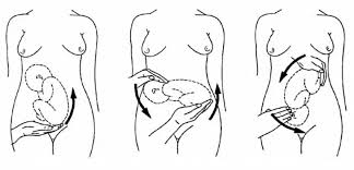 Image result for External Cephalic Version