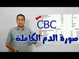 ما هو تحليل procalcitonin pct. Cbc Ø§Ø²Ø§Ù‰ ØªÙ‚Ø±Ø§ ØªØ­Ù„ÙŠÙ„ ØµÙˆØ±Ø© Ø§Ù„Ø¯Ù… Ø§Ù„ÙƒØ§Ù…Ù„Ø© Youtube