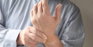 These injuries may take from two to 10 weeks to heal. Tfcc Wrist Injury Symptoms And Treatment Oh My Arthritis