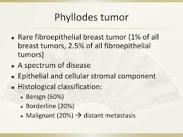 The standard treatment for phyllodes tumors is wide excision with sufficient surgical margins. Ppt Phyllodes Breast Tumor Powerpoint Presentation Free Download Id 4843647