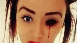 Cara merawat muka berjerawat paling penting adalah dengan rutin mencuci muka. Bangun Tidur Dengan Wajah Penuh Darah Rasanya Hidup Ini Seperti Hidup Di Film Horor Tribun Manado