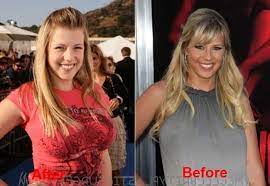 What event influenced little jodie's drug addiction? Jodie Sweetin Boob Job Jodie Sweetin Plastic Surgery And Her Appearance Now A Days Lights Fashion Beauty