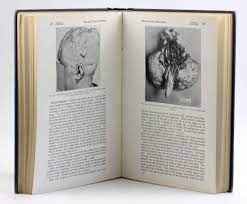 SURGERY OF THE BRAIN: A Monograph from Volume XII: Lewis's Practice of  Surgery by Danby, Walter: GOOD Hardcover (1945) | Arches Bookhouse