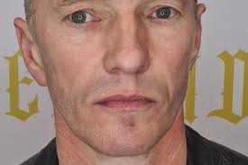 Beard Micropigmentation Treatment